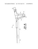 ENDOMETRIAL LINING TISSUE TREATMENT DEVICE diagram and image