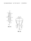 ENDOMETRIAL LINING TISSUE TREATMENT DEVICE diagram and image