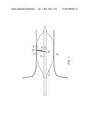 ABLATION TECHNIQUES FOR THE TREATMENT OF ATRIAL FIBRILLATION diagram and image