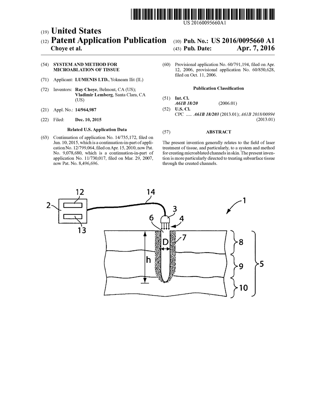 SYSTEM AND METHOD FOR MICROABLATION OF TISSUE - diagram, schematic, and image 01