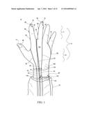 SURGICAL GLOVE SYSTEMS AND METHOD OF USING THE SAME diagram and image