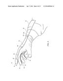 SURGICAL GLOVE SYSTEMS AND METHOD OF USING THE SAME diagram and image