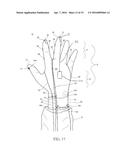 SURGICAL GLOVE SYSTEMS AND METHOD OF USING THE SAME diagram and image