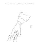 SURGICAL GLOVE SYSTEMS AND METHOD OF USING THE SAME diagram and image