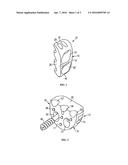 GLENOID EXTENSION BLOCK diagram and image