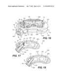 ARTICULATING EXPANDABLE INTERVERTEBRAL IMPLANT diagram and image