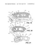 ARTICULATING EXPANDABLE INTERVERTEBRAL IMPLANT diagram and image