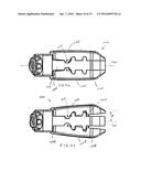 ARTICULATING EXPANDABLE INTERVERTEBRAL IMPLANT diagram and image