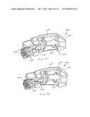 ARTICULATING EXPANDABLE INTERVERTEBRAL IMPLANT diagram and image