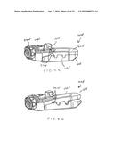 ARTICULATING EXPANDABLE INTERVERTEBRAL IMPLANT diagram and image