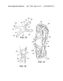 SUPPORT FOR ARTICLES AND METHODS FOR USING THE SAME diagram and image