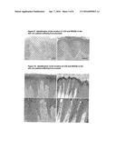 SUBSTANCE FOR RESTORING NORMAL CO-EXPRESSION AND INTERACTION BETWEEN THE     LOX AND NRAGE PROTEINS diagram and image