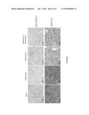 COMBINATION THERAPY CONTAINING A PI3K-ALPHA INHIBITOR AND FGFR KINASE     INHIBITOR FOR TREATING CANCER diagram and image