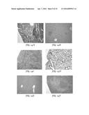 Controlled Release Vaccines and Methods of Treating Brucella Diseases and     Disorders diagram and image