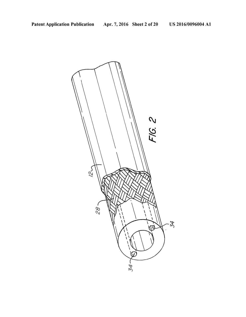 Steerable Catheter With Flexing Tip Member - diagram, schematic, and image 03