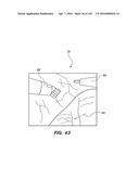 SYSTEM AND METHOD FOR OPTOGENETIC THERAPY diagram and image