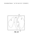 SYSTEM AND METHOD FOR OPTOGENETIC THERAPY diagram and image