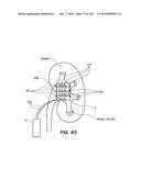 SYSTEM AND METHOD FOR OPTOGENETIC THERAPY diagram and image