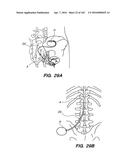 SYSTEM AND METHOD FOR OPTOGENETIC THERAPY diagram and image