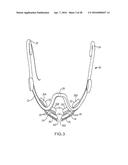 METHODS USEFUL FOR REMODELING MAXILLOFACIAL BONE USING LIGHT THERAPY AND A     FUNCTIONAL APPLIANCE diagram and image
