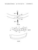 Ultrasound Transducer Matching Layers and Method of Manufacturing diagram and image