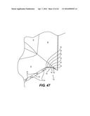 AERODYNAMIC TRACTOR-TRAILER GAP REDUCER AND ASSEMBLY THEREOF diagram and image