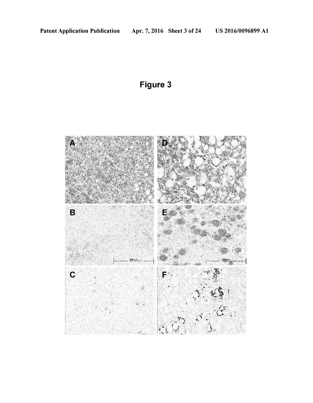 METHODS FOR TREATING JUVENILE ARTHRITIS WITH ANTI-BILE SALT-STIMULATED     LIPASE (BSSL) ANTIBODIES - diagram, schematic, and image 04