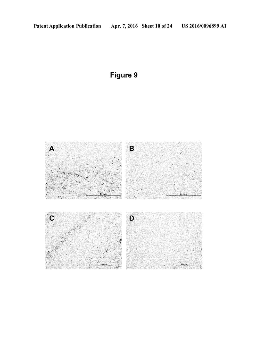 METHODS FOR TREATING JUVENILE ARTHRITIS WITH ANTI-BILE SALT-STIMULATED     LIPASE (BSSL) ANTIBODIES - diagram, schematic, and image 11