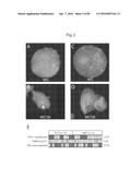 RECURRENT GENE FUSIONS IN PROSTATE CANCER diagram and image