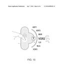 METHOD FOR DISPLAYING AND MANAGING COMMUNICATION-TYPE INTERACTION SYMBOLS     AND ASSOCIATED VIEWING DEVICE WITH A TOUCH SURFACE diagram and image