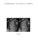 System and Method for Measurement of Myocardial Mechanical Function diagram and image