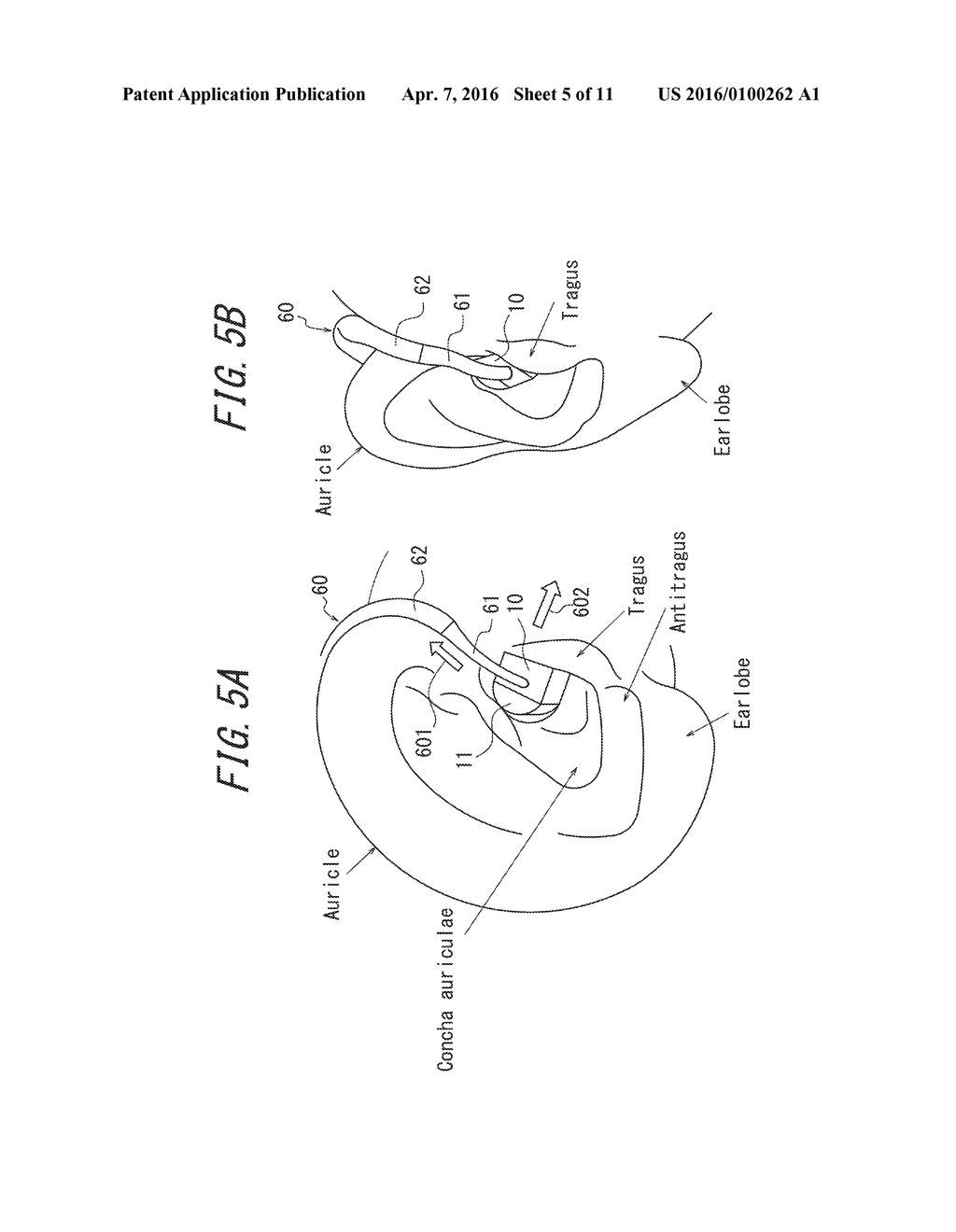 ACOUSTIC REPRODUCTION DEVICE AND SOUND-COLLECTING ACOUSTIC REPRODUCTION     DEVICE - diagram, schematic, and image 06