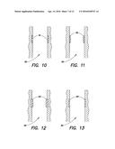 RIGID HEAD FOR A BODY PASSAGE DEVICE diagram and image