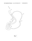 ENDOSCOPIC SYSTEM FOR ENHANCED VISUALIZATION diagram and image