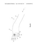 ENDOSCOPIC SYSTEM FOR ENHANCED VISUALIZATION diagram and image