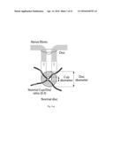 OBTAINING DATA FOR AUTOMATIC GLAUCOMA SCREENING, AND SCREENING AND     DIAGNOSTIC TECHNIQUES AND SYSTEMS USING THE DATA diagram and image