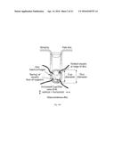 OBTAINING DATA FOR AUTOMATIC GLAUCOMA SCREENING, AND SCREENING AND     DIAGNOSTIC TECHNIQUES AND SYSTEMS USING THE DATA diagram and image