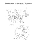 PATIENT-SPECIFIC GUIDES TO IMPROVE POINT REGISTRATION ACCURACY IN SURGICAL     NAVIGATION diagram and image