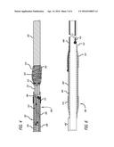 System And Method For Locating Detachment Zone Of A Detachable Implant diagram and image