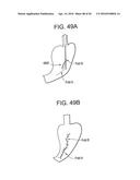 Devices and Methods for Endoluminal Plication diagram and image