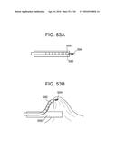 Devices and Methods for Endoluminal Plication diagram and image