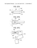 Devices and Methods for Endoluminal Plication diagram and image