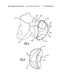 Patello-Femoral With Reusable Instruments diagram and image