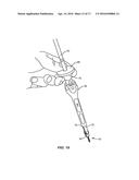 BONE SCREW EXTENDER REATTACHMENT SYSTEM AND METHODS diagram and image