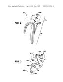 Surgical Device with Overload Mechanism diagram and image