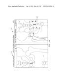 Systems and Methods for Intra-Operative Image Analysis diagram and image