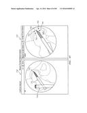 Systems and Methods for Intra-Operative Image Analysis diagram and image