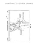 Systems and Methods for Intra-Operative Image Analysis diagram and image