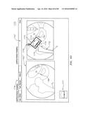 Systems and Methods for Intra-Operative Image Analysis diagram and image