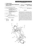 Dental repositioning device diagram and image